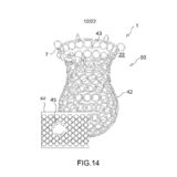 GRAD001-Fig-14 patent drafting services